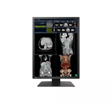 EIZO RadiForce RX270